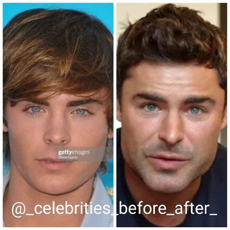 @_celebrities_before_after_ on Instagram: “Zac Efron before and after ...