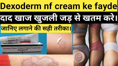 Dexoderm Nf Cream Ke Fayde Dexoderm Nf Cream Uses In Hindi Youtube