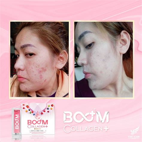 Boom Collagen Plus