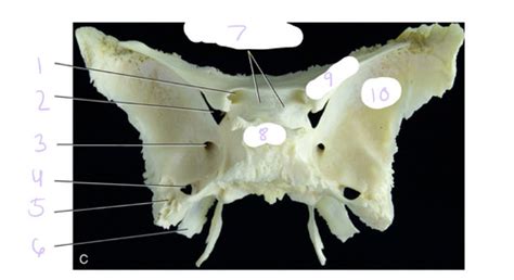 Sphenoid Bone Flashcards Quizlet