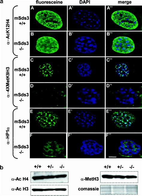 Msds Deficiency Impairs Pericentric Heterochromatin Structure A