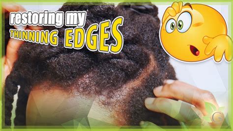 How I M Restoring My THINNING EDGES YouTube