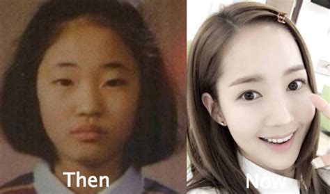 Park Min Young Plastic Surgery Before and After Photos