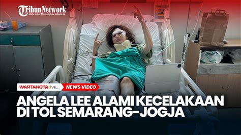 Kondisi Angela Lee Usai Alami Kecelakaan Mobil Pakai Penyangga Leher