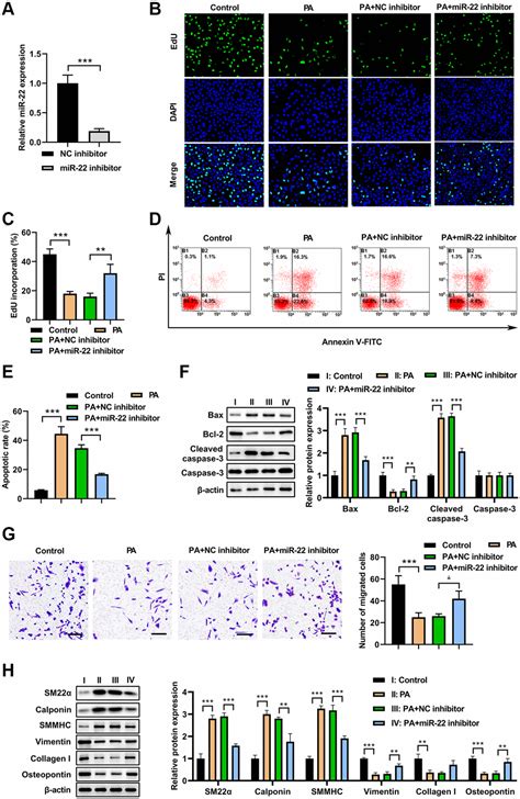 Palmitic Acid Inhibits Vascular Smooth Muscle Cell Switch To Synthetic