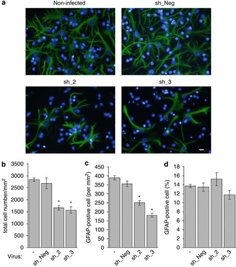 Lentivirus Mediated Shrna Interference Targeting Znf Inhibits The