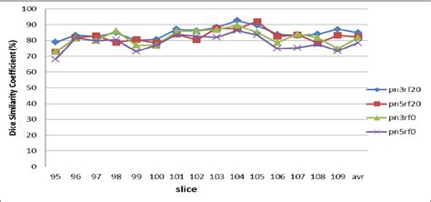 Figure 2 From Automatic Segmentation Of Multiple Sclerosis Lesions In Multispectral Mr Images