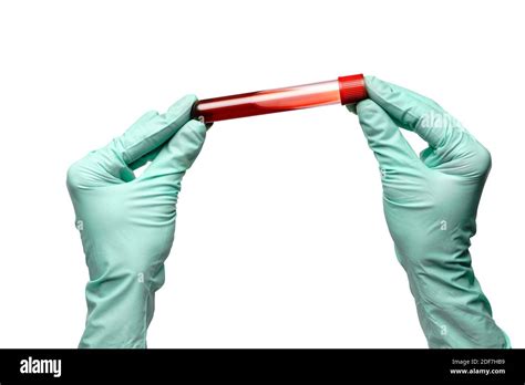 Hand In Latex Glove Holding Blood Sample In Test Tube Close Up Isolated