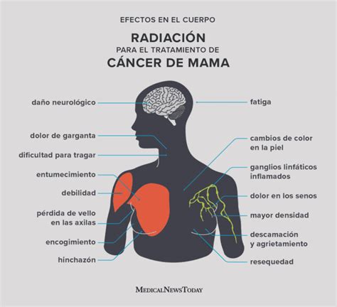 C Ncer De Mama Causas S Ntomas Y Tratamientos