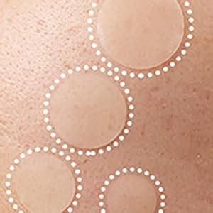 Zemolo 300pcs Pimple Patches Spot Patches Hydrocolloid Acne Patches