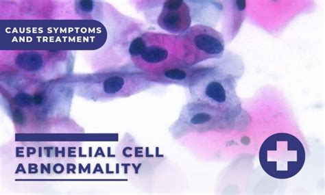 Epithelial Cell Abnormality: Causes Symptoms and Treatment