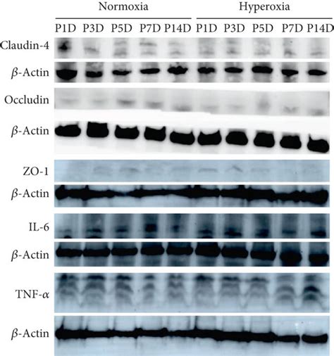 Tight Junction Protein Expression Is Positively Correlated With That Of