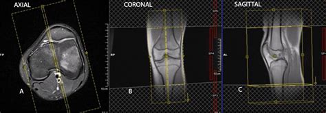 Knee MRI RadTechOnDuty