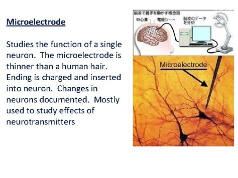 Types Of Brain Imaging Techniques Microelectrode Examines