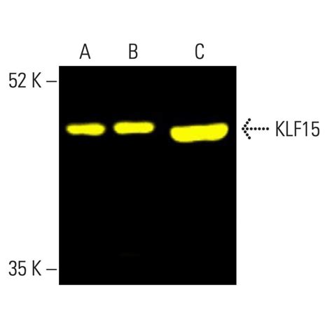 KLF15抗体 A 5 SCBT Santa Cruz Biotechnology