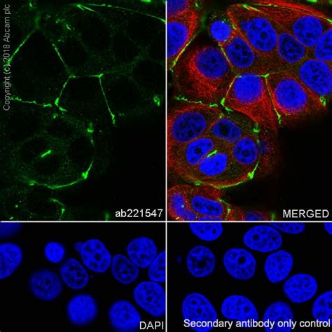 重组ZO1 tight junction protein抗体 EPR19945 296 Abcam