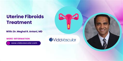 The Minimally Invasive Procedure To Treat Uterine Fibroids Vidavascular