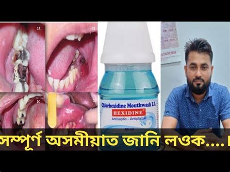 Hexidine Mouthwash Antiseptic Antiplaque Antiviral Antifungal Youtube