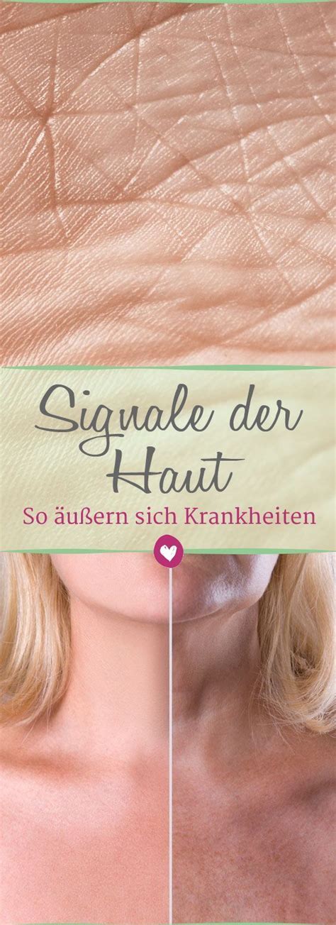 Hautsignale Was das größte Organ über Gesundheit verrät