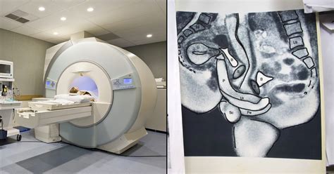 A Couple Had Sex In An MRI Machine All For Science ScoopWhoop