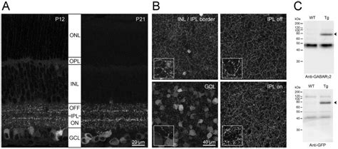 A Maximum intensity projections MIP of confocal image stacks 2 µm