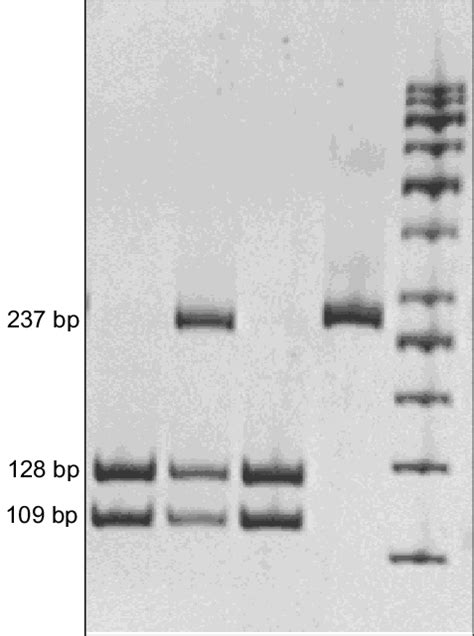 Ivs Ga Heterozygous Control Dna Sample Lane With Taii