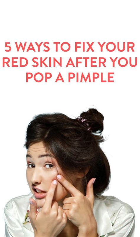 5 Ways To Care For Your Skin After Popping A Pimple Beauty Skin Skin