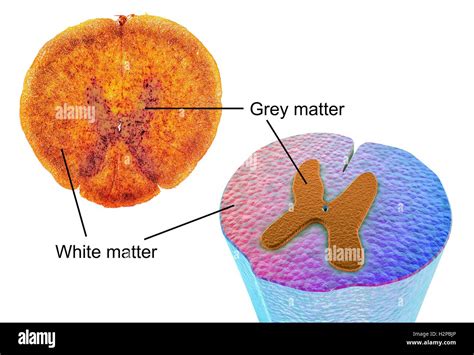 Spinal Cord Cross Section Light Micrograph And Computer Illustration Of A Spinal Cord Showing