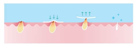 Comparison of before and after blackhead removal Vector Image