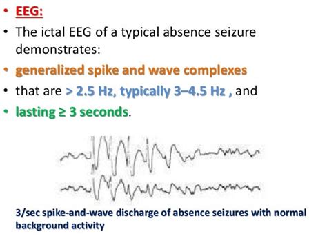 Absence Seizures Dr Padmesh