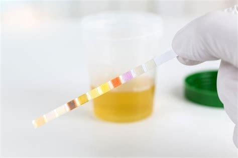 Ketones In Urine When And Why To Test For Them And What 57 Off