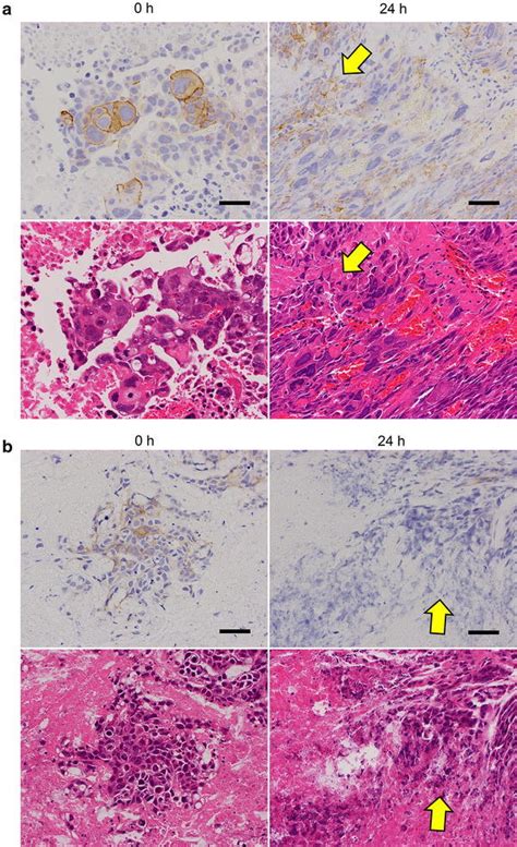 Effect Of Time To Fixation On Ihc Staining For Her2 In Tumor Tissue Download Scientific Diagram