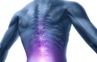 spine-doctor-near-me-in-orlando - Innovative Pain Solutions