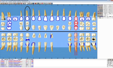 dentrix enterprise software reviews demo pricing