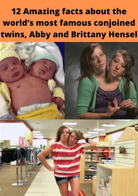 Amazing Facts About The Worlds Most Famous Conjoined Twins Abby