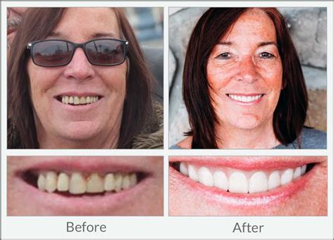 Smile Gallery Dental Excellence