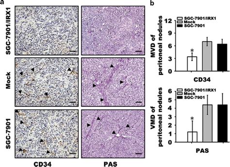 Assays Of Microvessel Density MVD Or Vasculogenic Mimicry Density