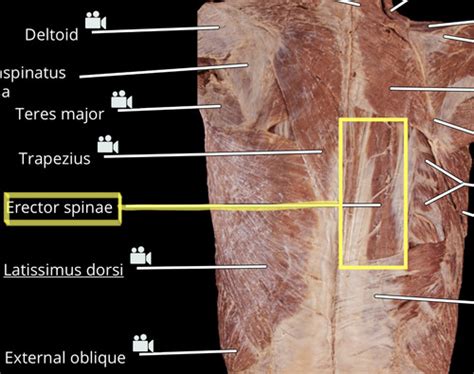 Cadaver Muscles Flashcards Quizlet