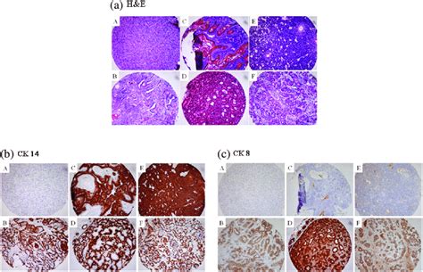 Histologic Characterization Of Mammary Tumors Dmba Induced Mammary