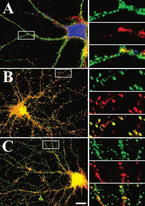 Surface Expression Patterns Of Ampar Subunits In Hippocampal Neurons