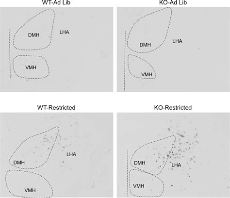 Figure 2 From Enhanced Food Anticipatory Activity Associated With