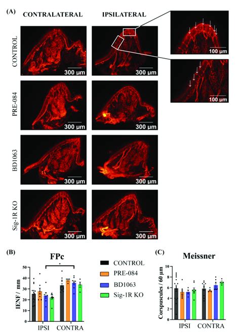 Reinnervation Of Intra Epidermal Nerve Fibers IENF And Meissner S