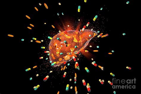 Drug Induced Hepatotoxicity Photograph By Kateryna Kon Science Photo