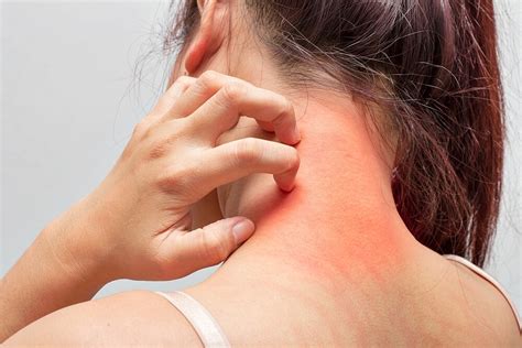 Itchy Skin Pruritus Causes And Treatment Options