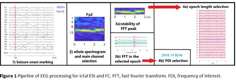 Ictal-EEG-Source-Imaging-and-Connectivity-to-Localize-the-Seizure-Onset ...