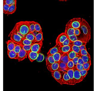 10 Must-have Markers for Cell Senescence Research