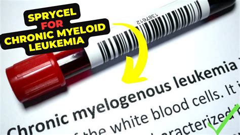 Sprycel: A Breakthrough Treatment for Chronic Myeloid Leukemia. - YouTube