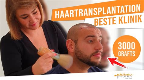 Haartransplantation Beste Klinik Ph Nix Hair Trans