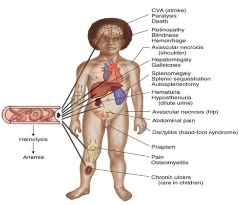 Peds Final Exam Review Flashcards Quizlet