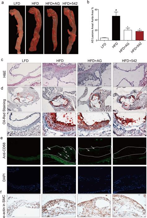 Egfr Inhibitors Prevented Atherosclerotic Plaque Development In Hfd Fed